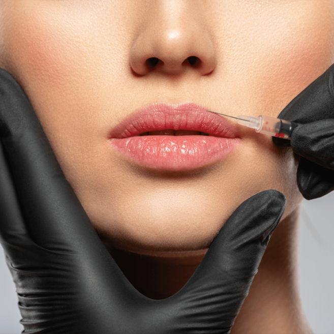 Lips : All About the Lips - GLO Aesthetics | Med Spa, Facial & Skin Health